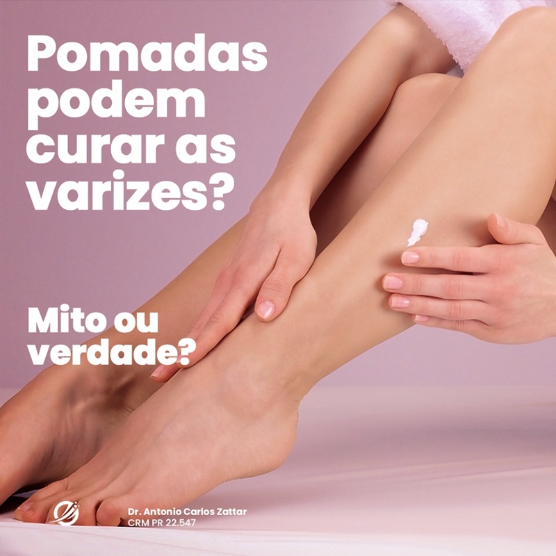 Pomadas podem curar as varizes?