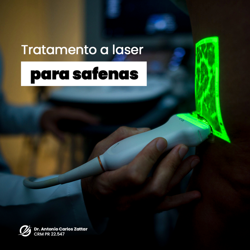 Tratamento a laser de safena 