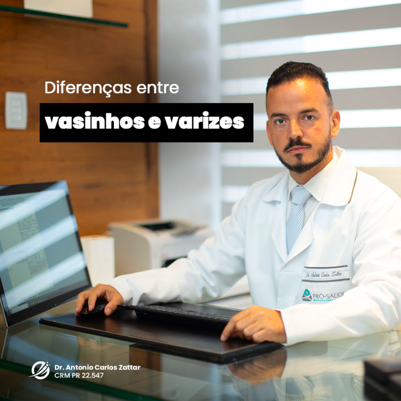 Diferença entre vasinhos e varizes